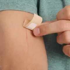 Dłoń przykleja plaster na zadrapanie na ramieniu. To mały kompres na drobne skaleczenie.