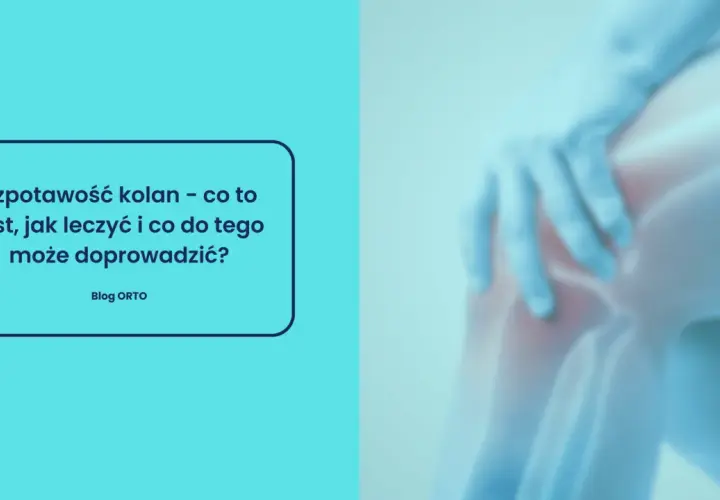 Szpotawość kolan: przyczyny, leczenie i skutki. Grafika przedstawia zniekształcone kolano, sugerując problem medyczny.
