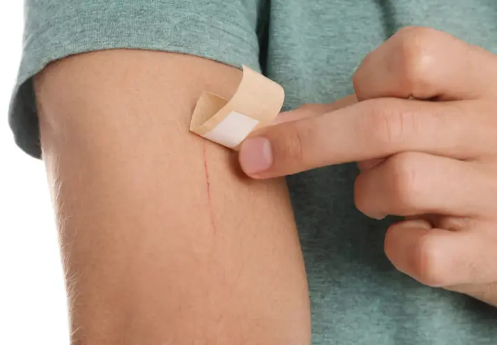 Dłoń przykleja plaster na zadrapanie na ramieniu. To mały kompres na drobne skaleczenie.