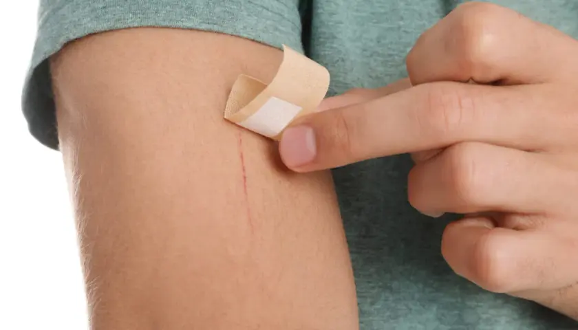 Dłoń przykleja plaster na zadrapanie na ramieniu. To mały kompres na drobne skaleczenie.