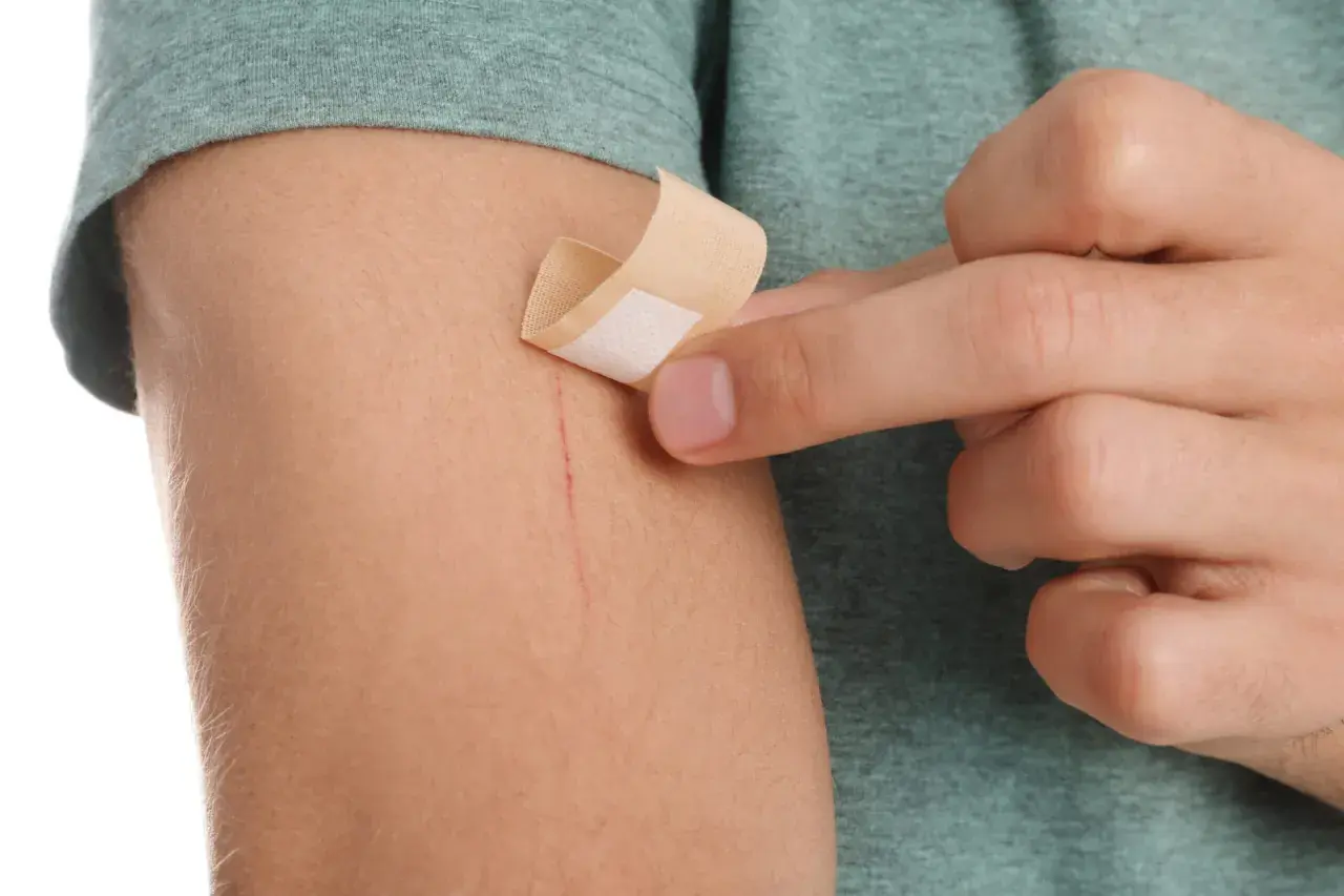Dłoń przykleja plaster na zadrapanie na ramieniu. To mały kompres na drobne skaleczenie.